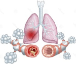 prebiotica-astma