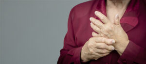 Rheumatoid arthritis hands